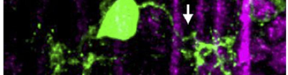 Motor Neuron Dendrites